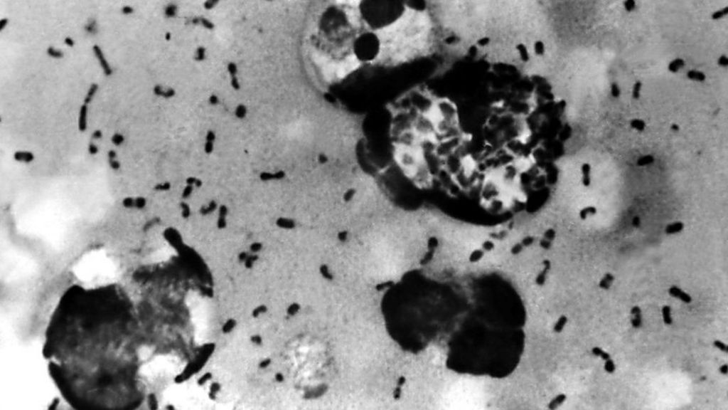 The Bubonic Plague: Explained